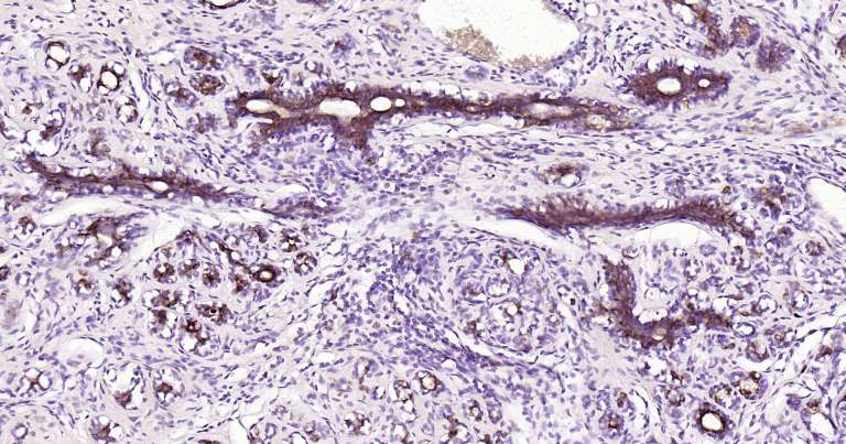 人细胞角蛋白18即用型免疫组化试剂盒-IHC0249H